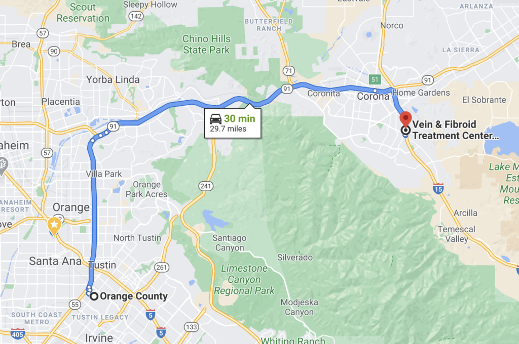 Directions from Orange County to Best Spider Vein Treatment Center in Corona.