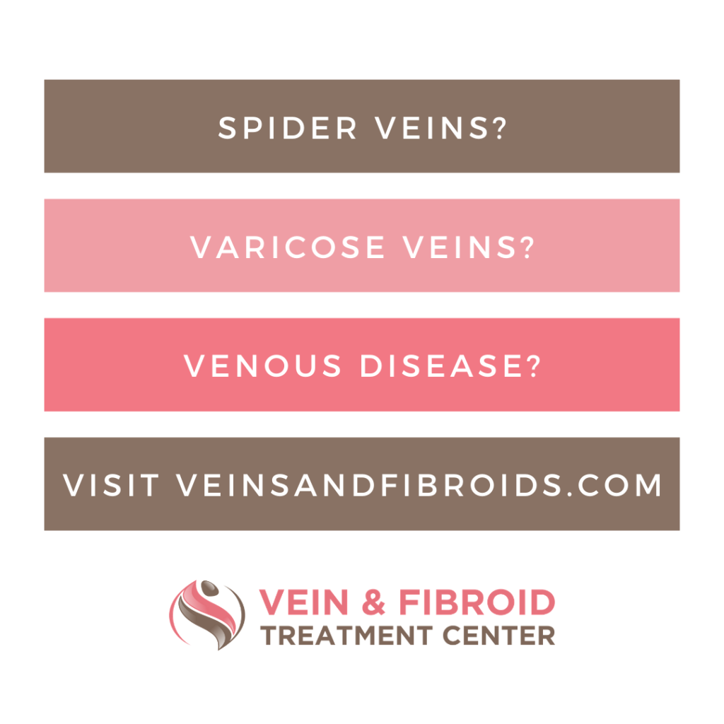 Spider Veins, Varicose Veins, Venous Disease. Treatment options with Dr. Omar Saleh at the Corona Vein and Fibroid Treatment Center.